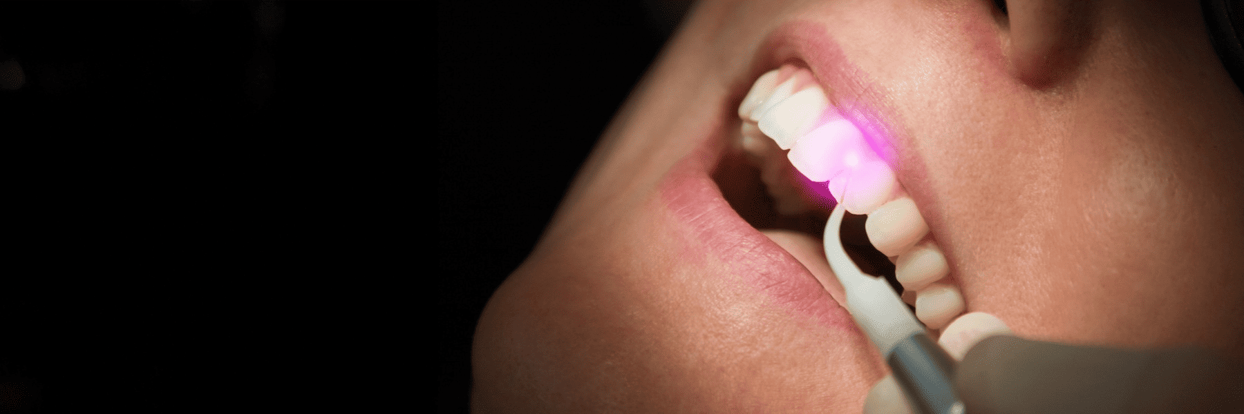 Biological Gum Therapy | Dentist